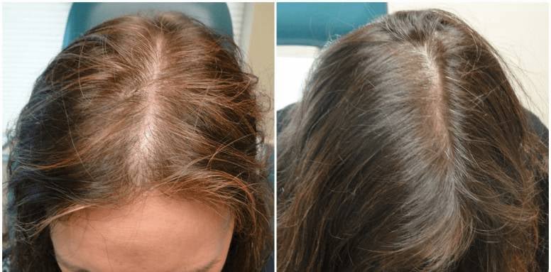 Folital-Nature-Ingredients-Focus